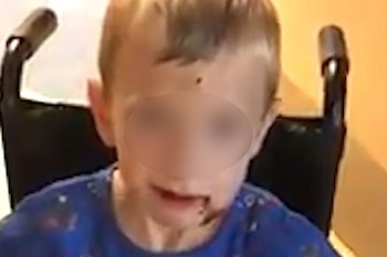 En las imágenes, las heridas