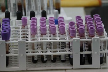 Especialistas subrayan la importancia de