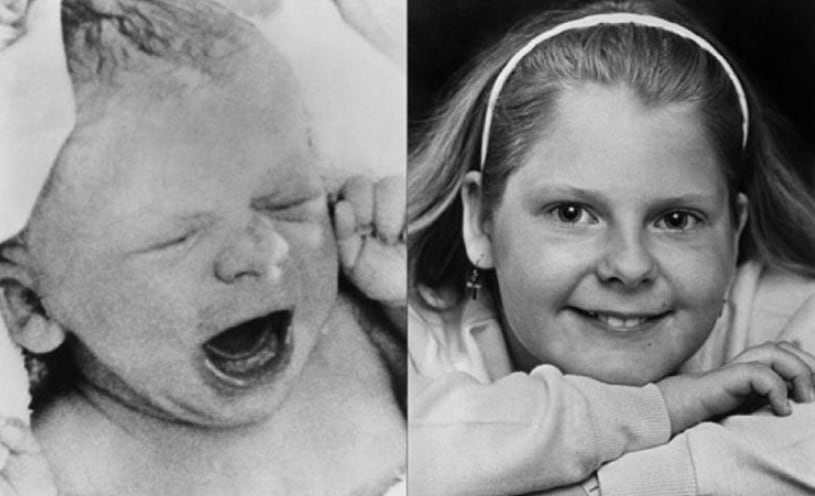Louise Brown recién nacida y unos años más tarde.