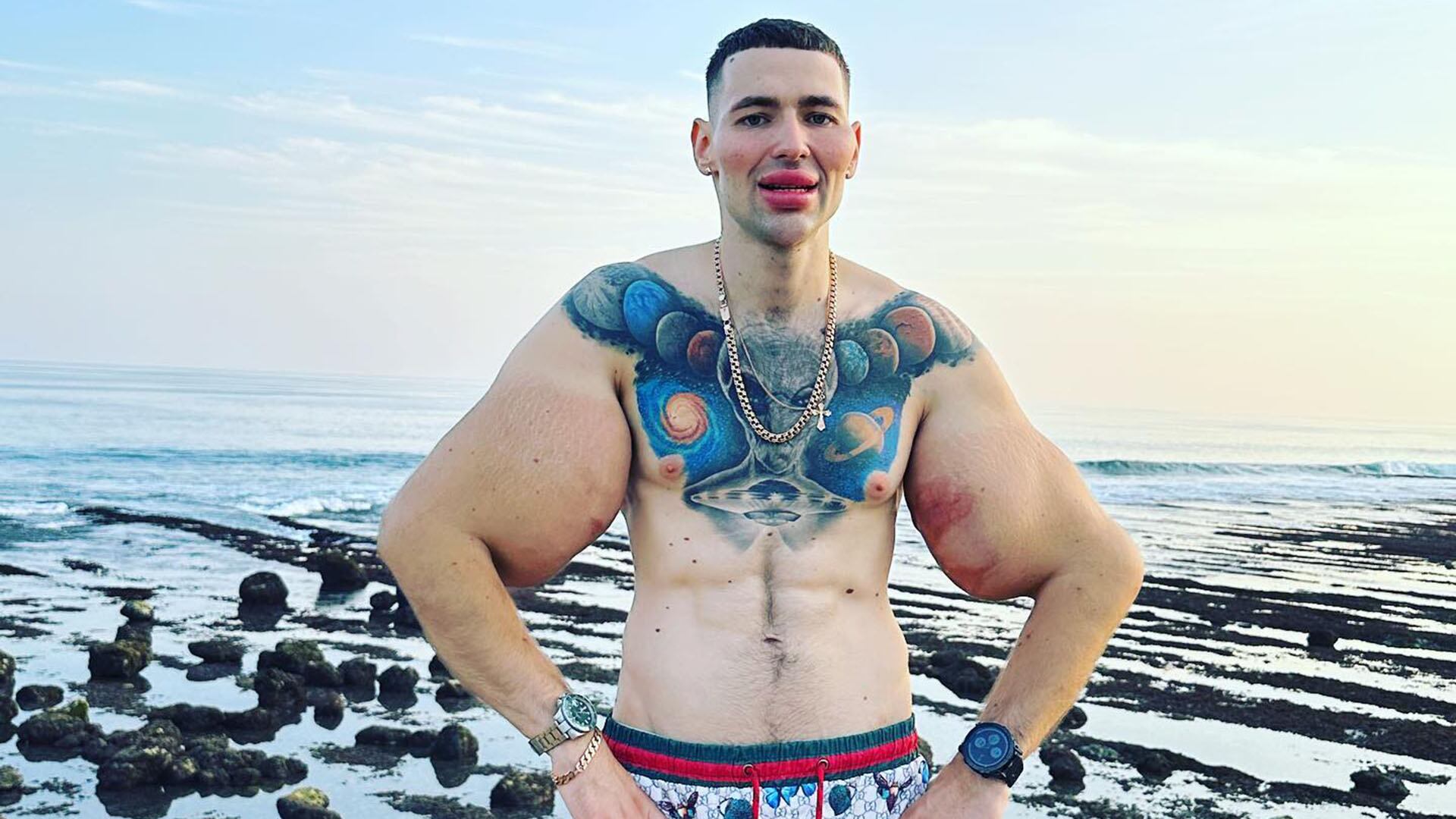 El Popeye Ruso admitió que está pagando las consecuencias de haberse inyectado aceite y otras sustancias en sus brazos (@kirilltereshin96)