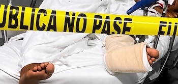 La Fuerza Pública y el OIJ mantienen abiertas las investigaciones para dar con el paradero de los dos encapuchados que irrumpieron en el centro hospitalario (Cortesía: TN7).