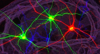 El estudio en la Universidad