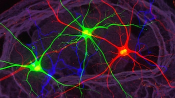 Identifican el “interruptor” cerebral que
