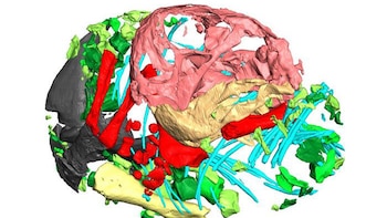 Reconstrucción 3D del esqueleto