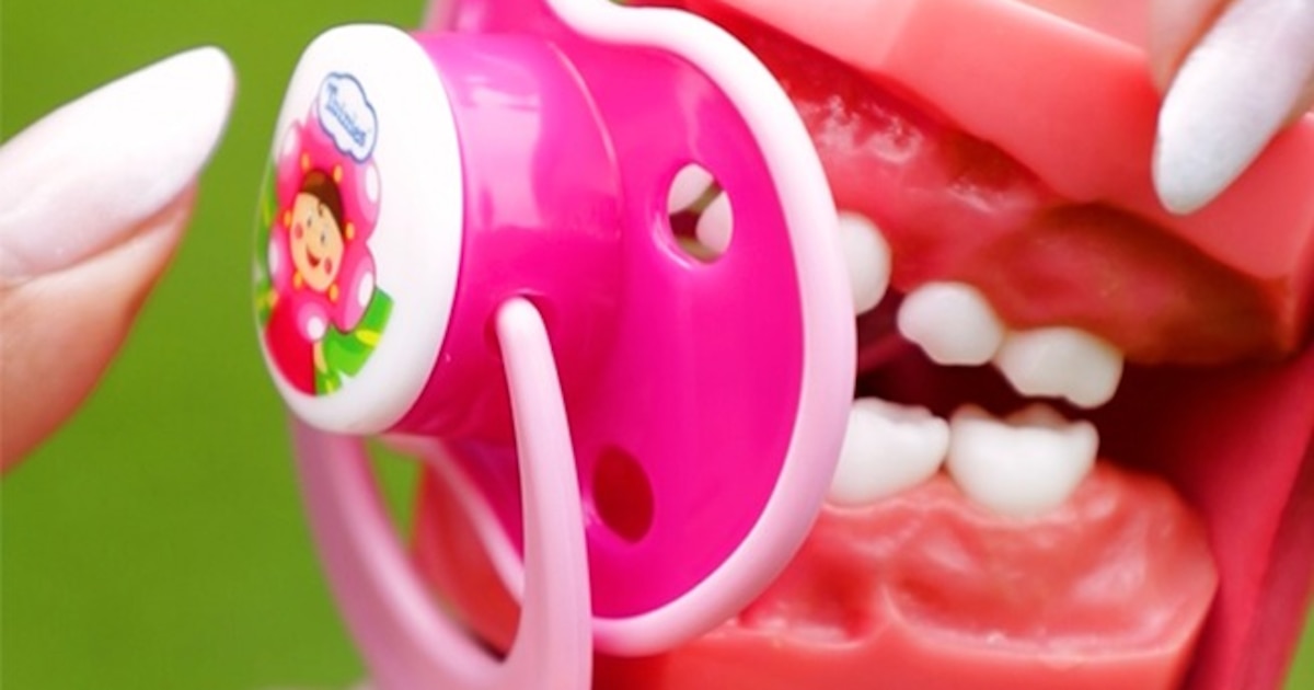 ¡Alerta al uso prolongado de chupetes en bebés! El Ministerio de Salud advierte sobre posibles riesgos para la lactancia