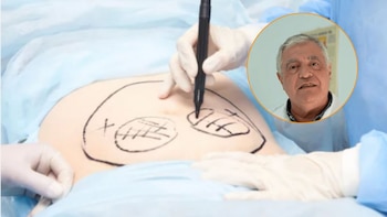 Miguel Saldaña, cirujano: “Hacerte una