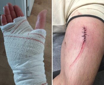 Agresiones a funcionarios de prisiones