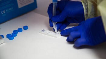 Expertos advierten que los test