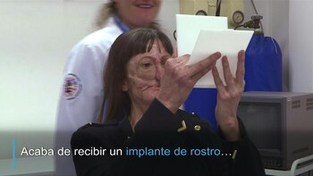 Una nueva tecnología permite la