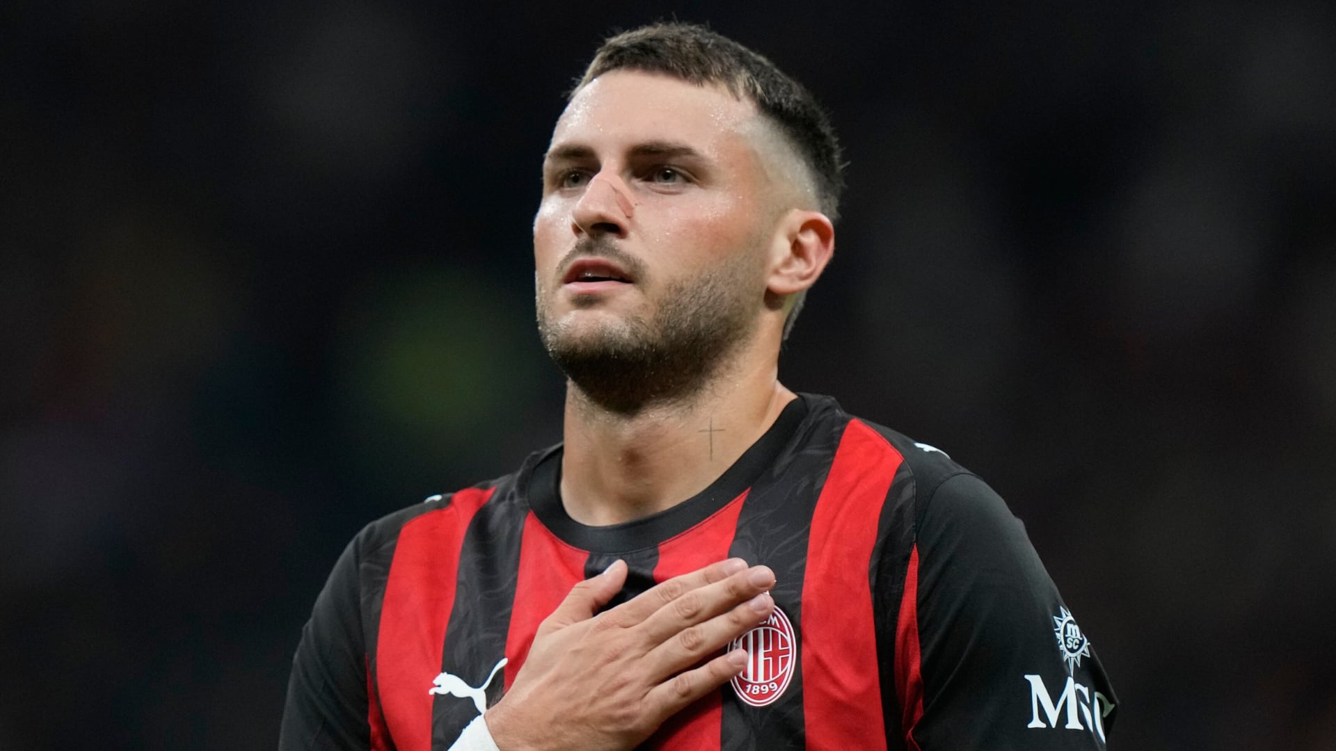 (AP Foto/Luca Bruno)