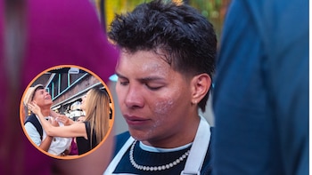 Emiro Navarro sufrió grave quemadura en la cara con aceite en reto de ‘MasterChef Celebrity’