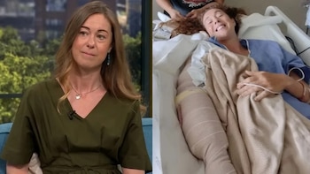 Helen Fairlamb mostró las secuelas del ataque que sufrió en 2024