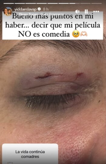 Yiddá Eslava sufre fuerte accidente