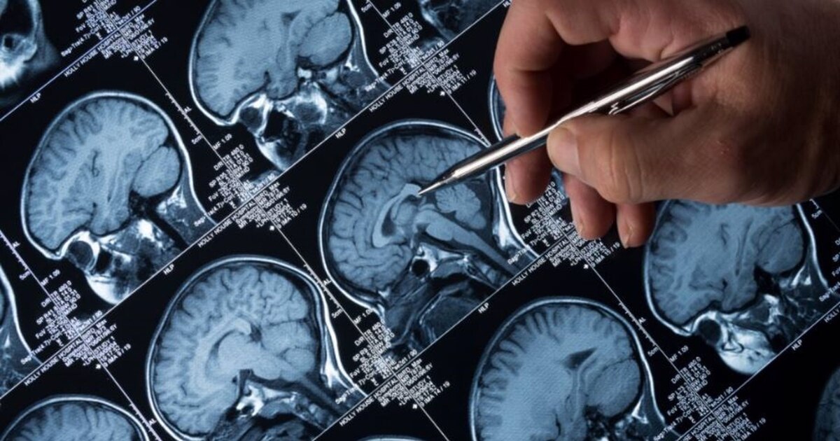 Descubre los efectos ocultos de la depresión en tu salud física