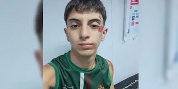 Martín Suárez sufrió varios moretones