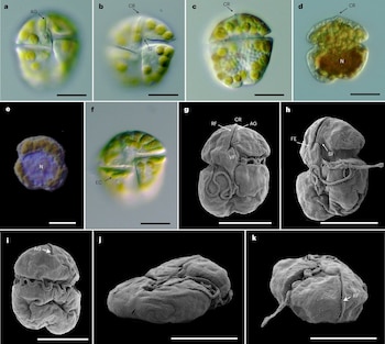 Detectan la microalga más tóxica del mundo en Australia