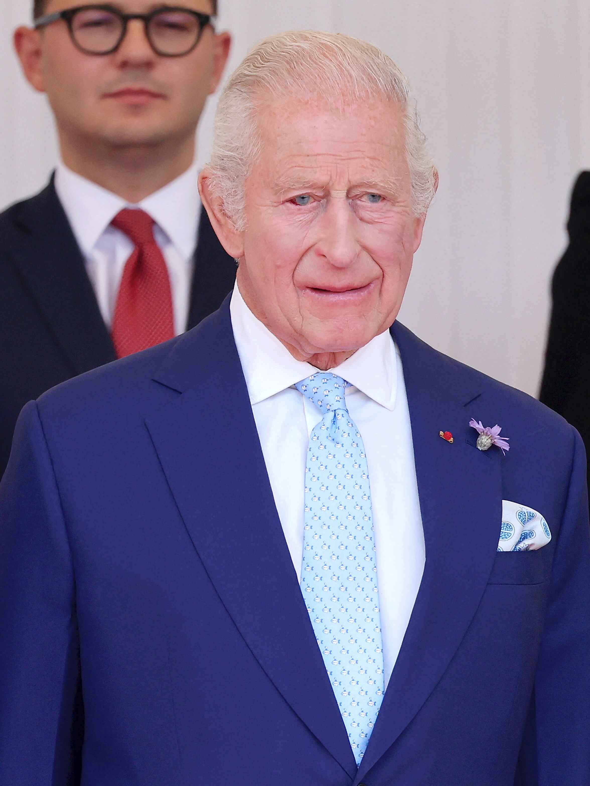 Carlos III con un derrame ocular.