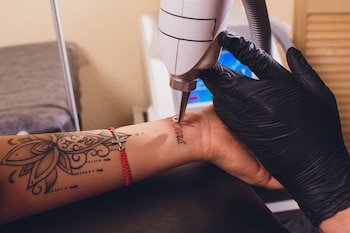 Los especialistas recomiendan consultar a