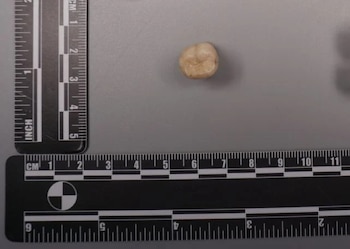 Rastros de material genético de Homo erectus persisten en el ADN de algunas poblaciones modernas (IVPP)
