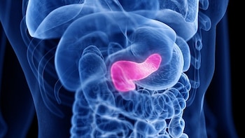 El índice de riesgo ayuda