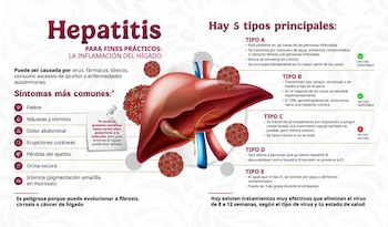 Infografía que presenta la hepatitis. Ilustración de un hígado, virus. Texto sobre causas, síntomas, cinco tipos (A, B, C, D, E), modos de transmisión y vacunas