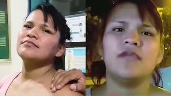 Dos imágenes muestran el rostro de una mujer en primer plano, la de la izquierda con una mano en el hombro, la de la derecha con fondo oscuro