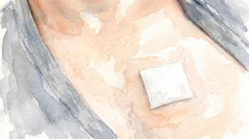 Ilustración en acuarela de un brazo con un parche cuadrado blanco en la piel. Se observa parte de una manga grisácea.