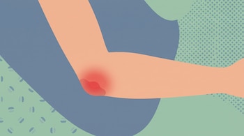 Ilustración gráfica de un brazo flexionado con una marca enrojecida en el codo sobre un fondo abstracto azul y verde.