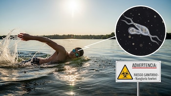 Naegleria fowleri: Riesgo sanitario en lagos durante el verano - VisualesIA ScribNews
