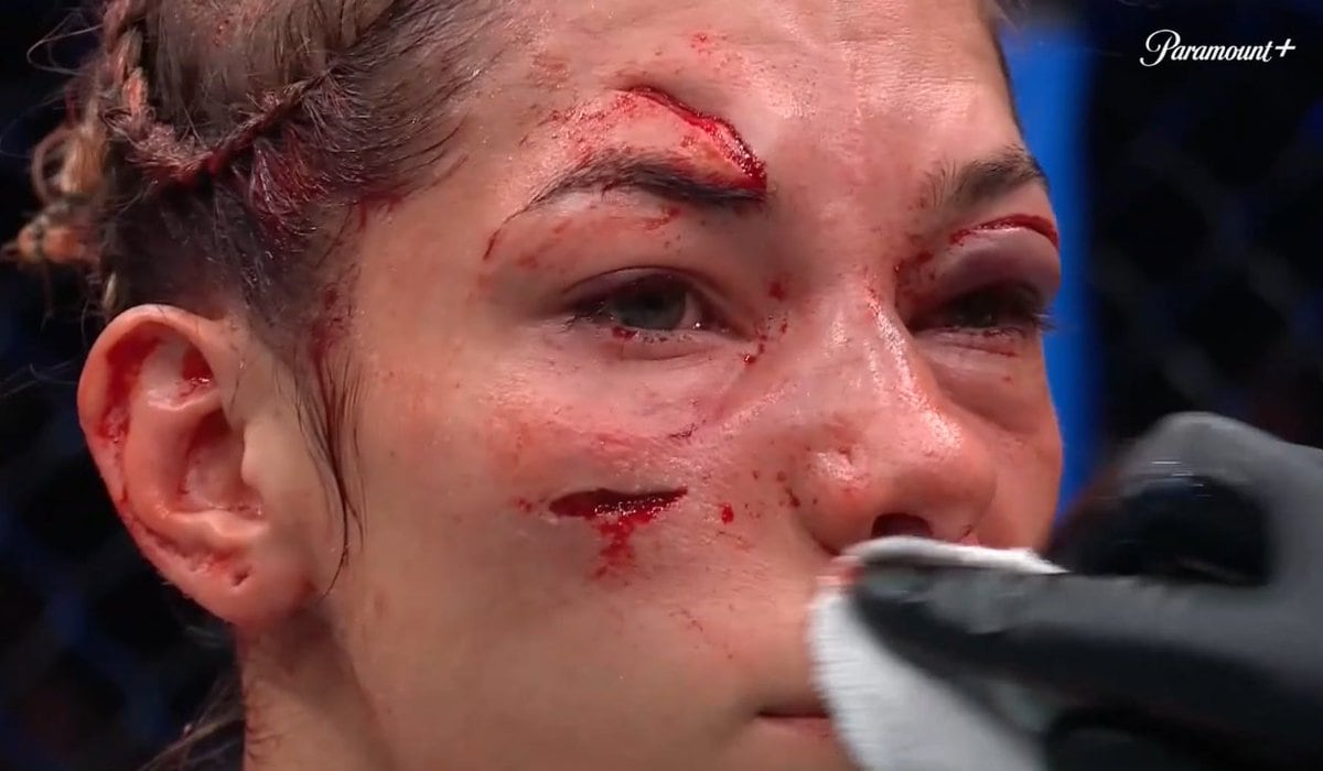 Las heridas que sufrió Sofía Montenegro en su rostro durante el combate de este sábado