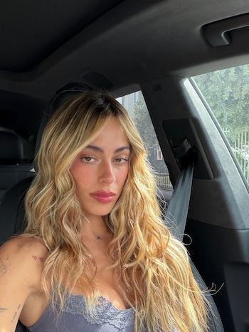 "Hay veces que uno tiene lesiones o te puede pasar emocionalmente también", explicó la artista en su última entrevista (Instagram)