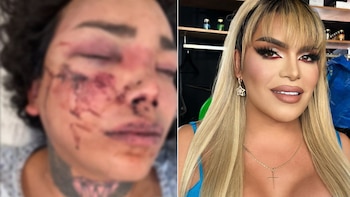 Paola Suárez fue ingresada a