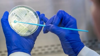 Dos manos con guantes azules sostienen una placa de Petri. La placa contiene colonias de microorganismos y un medio de cultivo. Una aguja de siembra azul toca las colonias