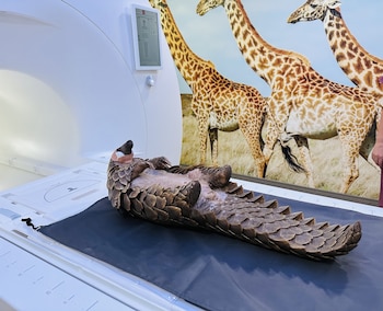 La resonancia magnética reveló una