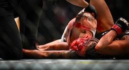 La argentina Sofía Montenegro mostró cómo quedó su rostro tras la sangrienta pelea que perdió en su debut en UFC
