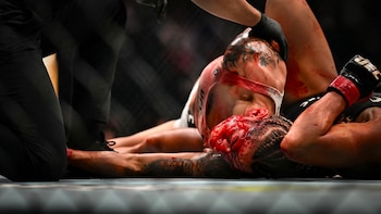 La argentina Sofía Montenegro mostró cómo quedó su rostro tras la sangrienta pelea que perdió en su debut en UFC