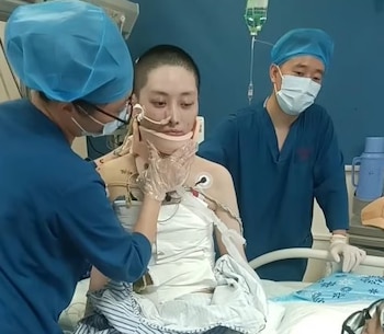 Wan Anan fue sometida a varias cirugías para salvar su vida.