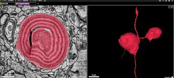 Mapa cerebral Google Harvard