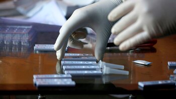 Alemania donó 100,000 pruebas de