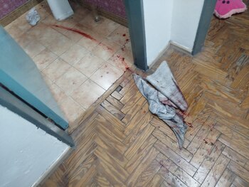 La mujer recibió dos balazos