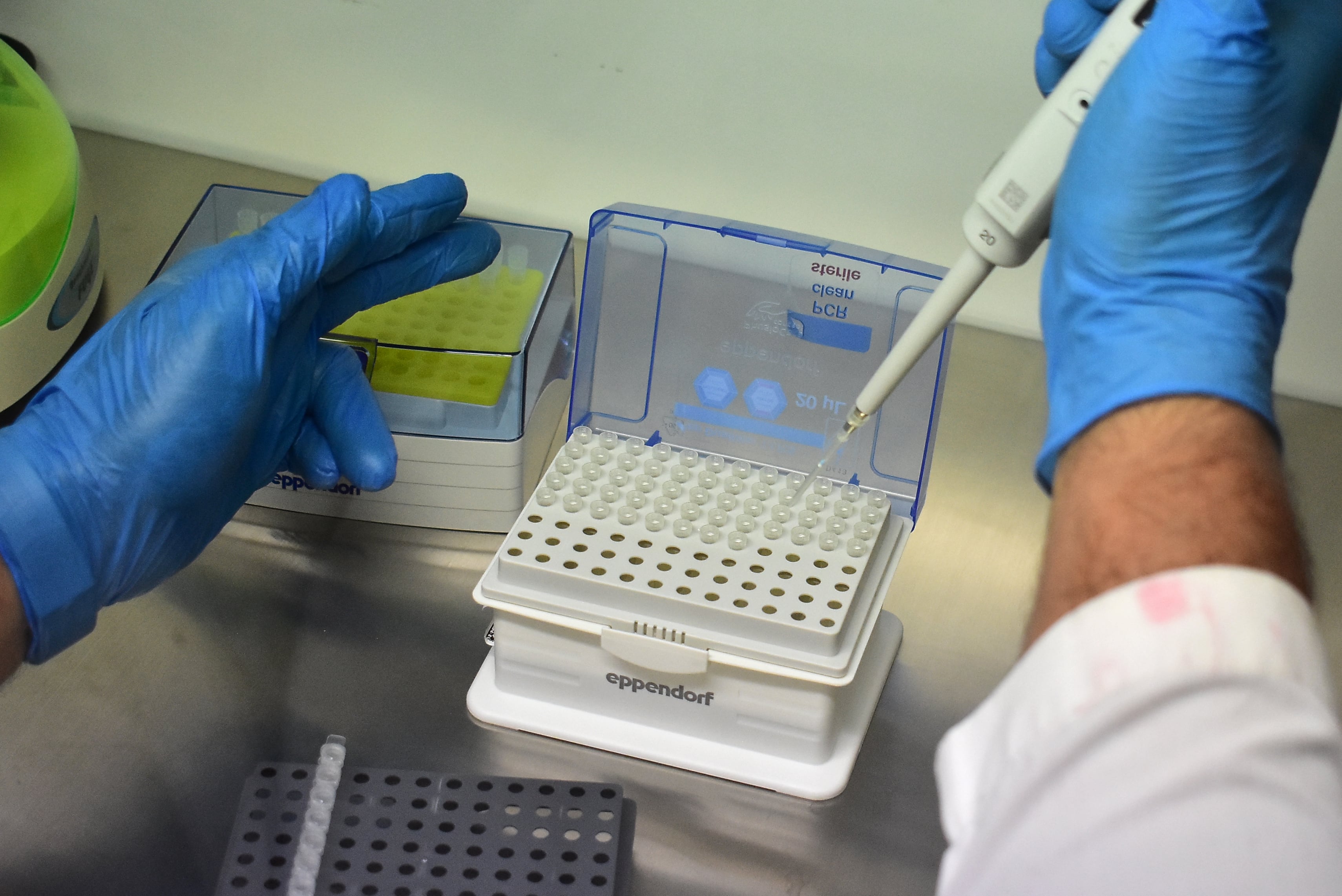 La investigación señaló que los genotipos 1 y 2 del virus Epstein-Barr pueden influir en el comportamiento clínico, epidemiológico y pronóstico del linfoma de Hodgkin./ (Infobae Centroamérica/Emerson Del Cid)