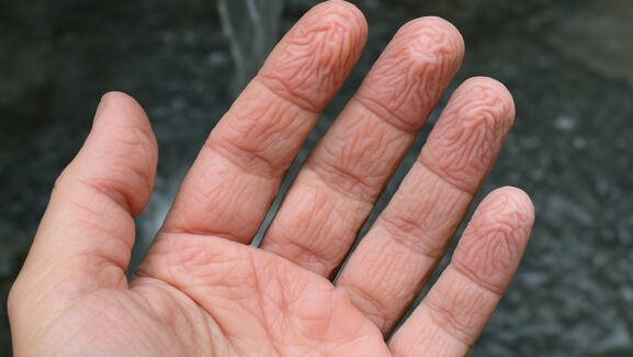 El hallazgo descarta la creencia de que las arrugas se deben solo a la absorción de agua y apunta a un control nervioso del proceso. (Imagen Ilustrativa Infobae)