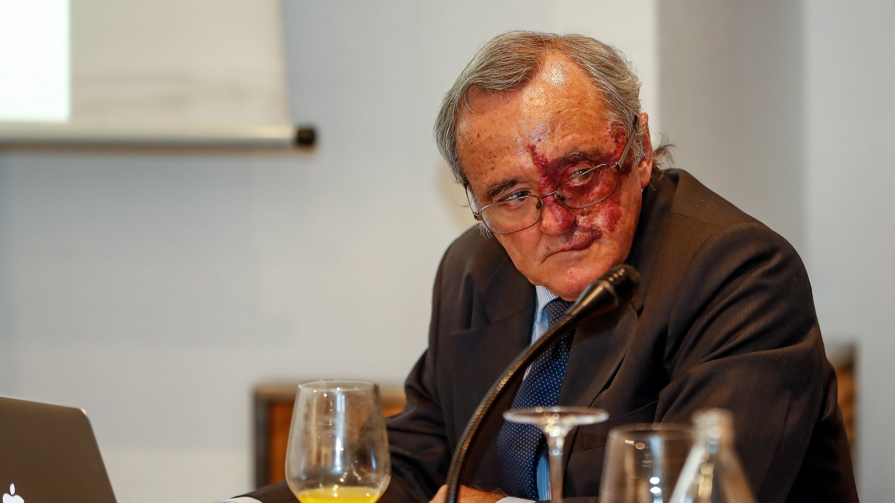 El estudio de Barbacid del cáncer de páncreas, a caballo entre la esperanza y la realidad: “Muchas cosas que funcionan en ratones luego no lo hacen en humanos”