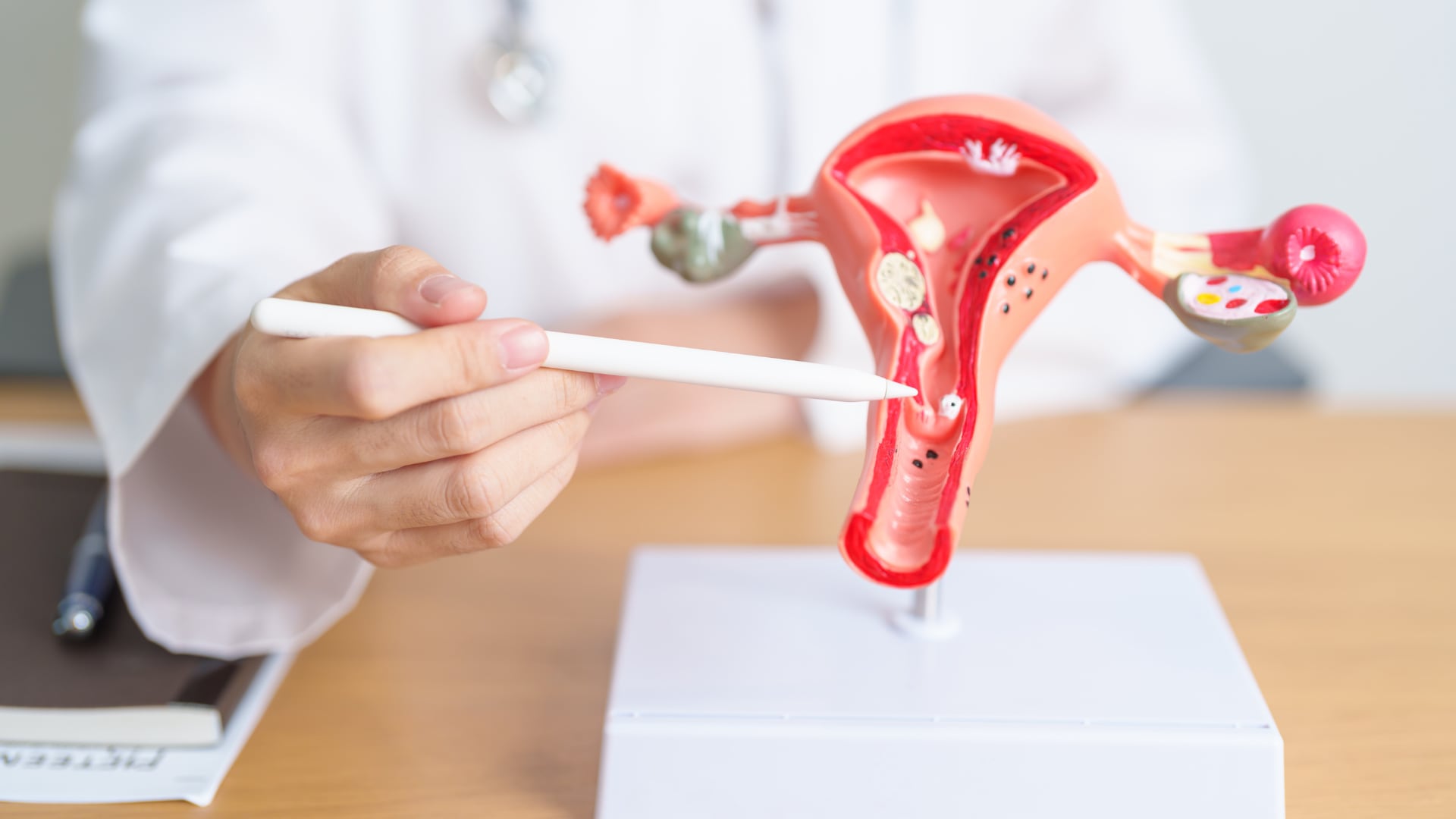 Nueva terapia contra el cáncer de ovario reduce la toxicidad del tratamiento