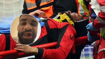 La impactante imagen del futbolista