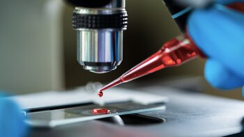 Cómo es el nuevo test