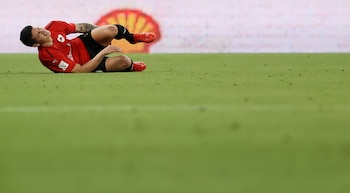 James tiene una contusión en