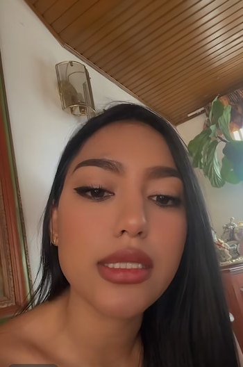 Rojas aseguró que tuvo problemas iniciales para recibir atención mediante la Administradora de Riesgos Laborales - crédito @maria.a.rojas84/ TikTok