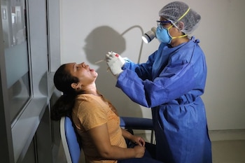 COVID-19 en Perú: 912 nuevos