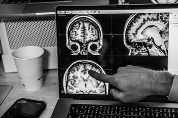 El uso de ultrasonidos focalizados